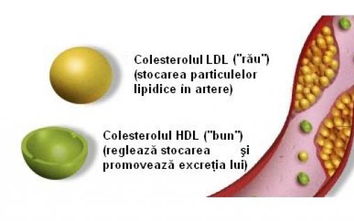 Colesterolul și trigliceridele - ALARMĂ!